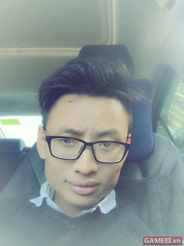 Hưng Hại Não