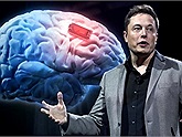 Vị tỷ phú Elon Musk đang lên kế hoạch thử nghiệm cấy chip vào não người