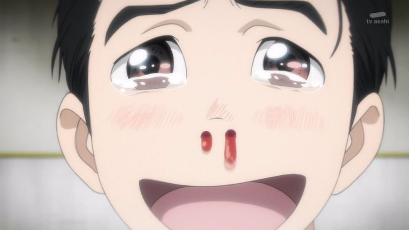 Chảy máu mũi mỗi khi gặp gái xinh - Sự khác biệt giữa anime và thực tế
